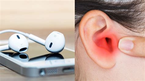 why are my earbuds quality with phone bad